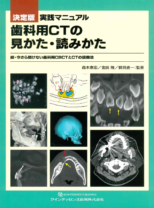 歯科用CTの見かた・読み方