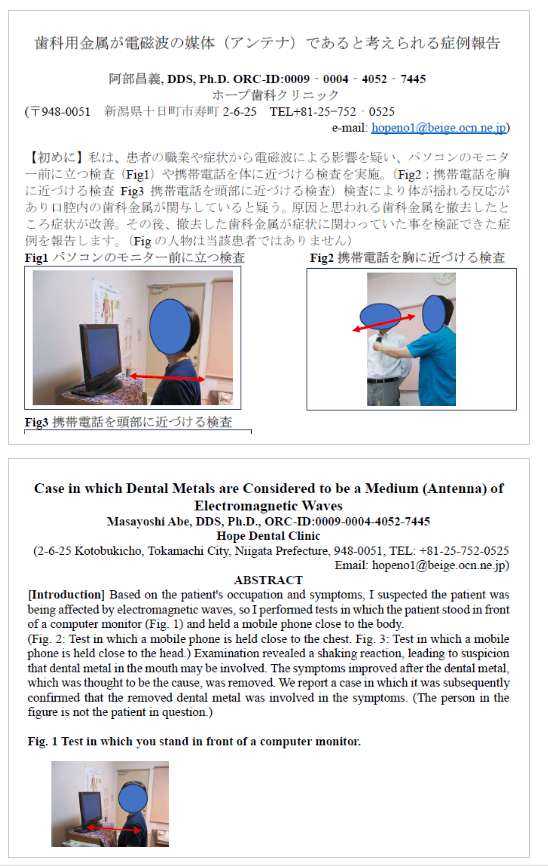 オーリングテストとは